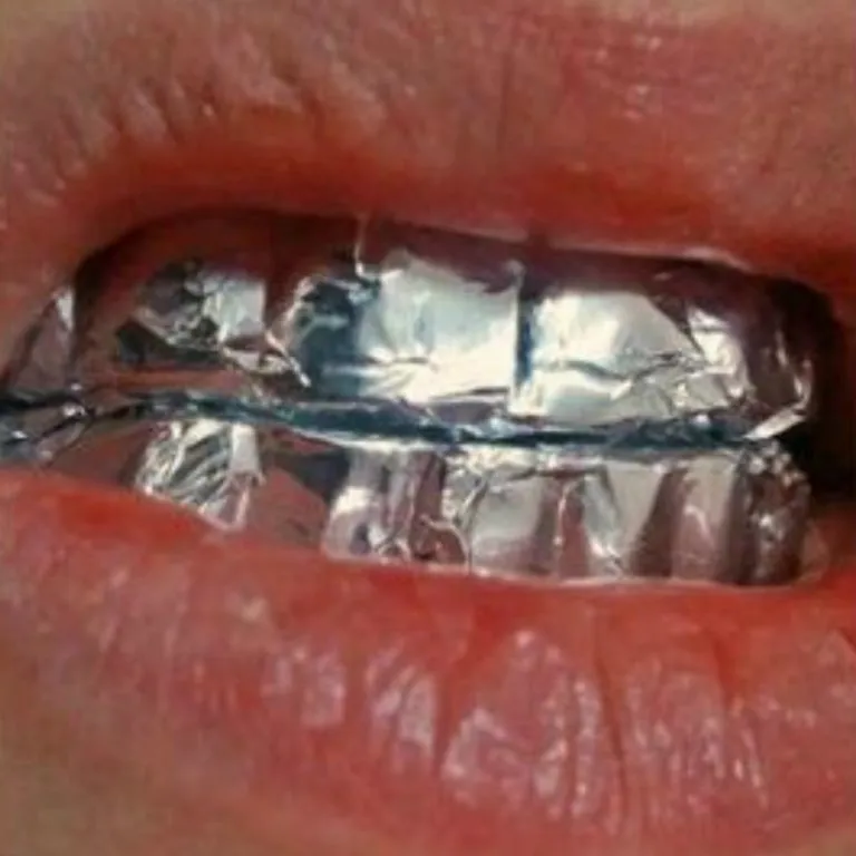32055 applying aluminum foil teeth