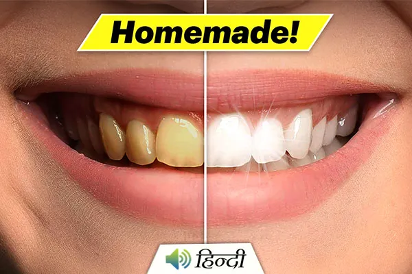 32062 coconut oil teeth whitening