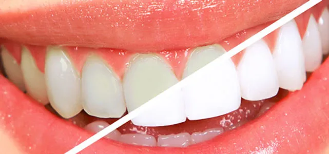 32064 dental consultation