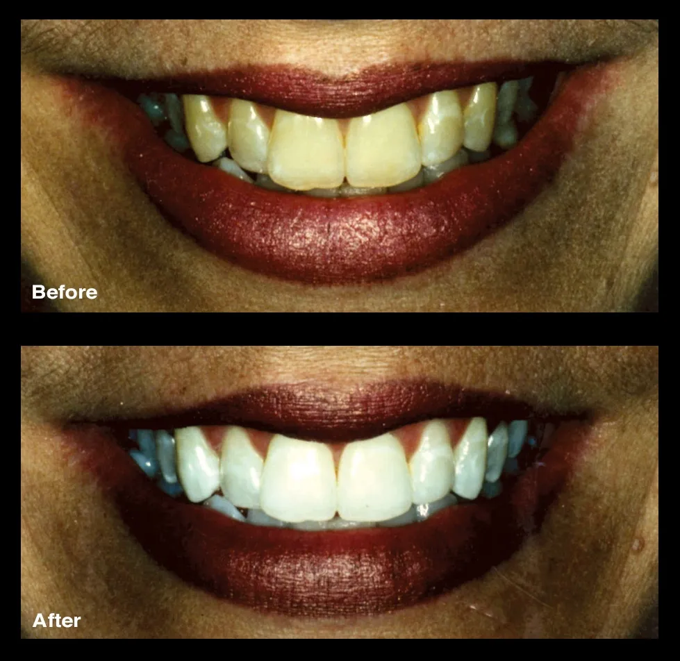 32066 dental checkup