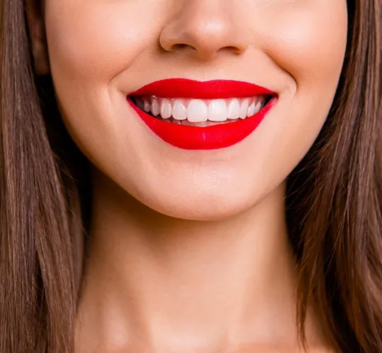 32071 at home teeth whitening kit