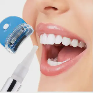 /img/32076-laser-teeth-whitening-uxbridge-patient-consultation.webp