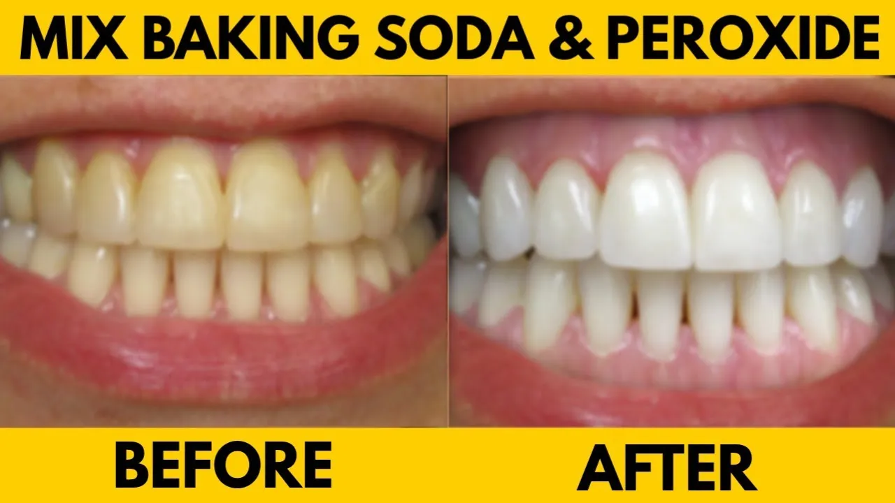 32077 baking soda teeth cleaning