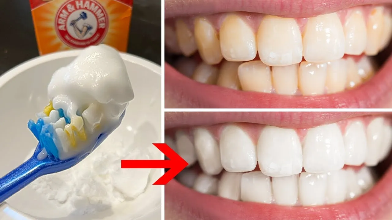 32077 teeth whitening baking soda water