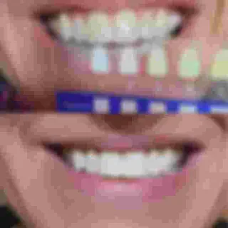 /img/32080-polar-night-teeth-whitening-comparison.webp