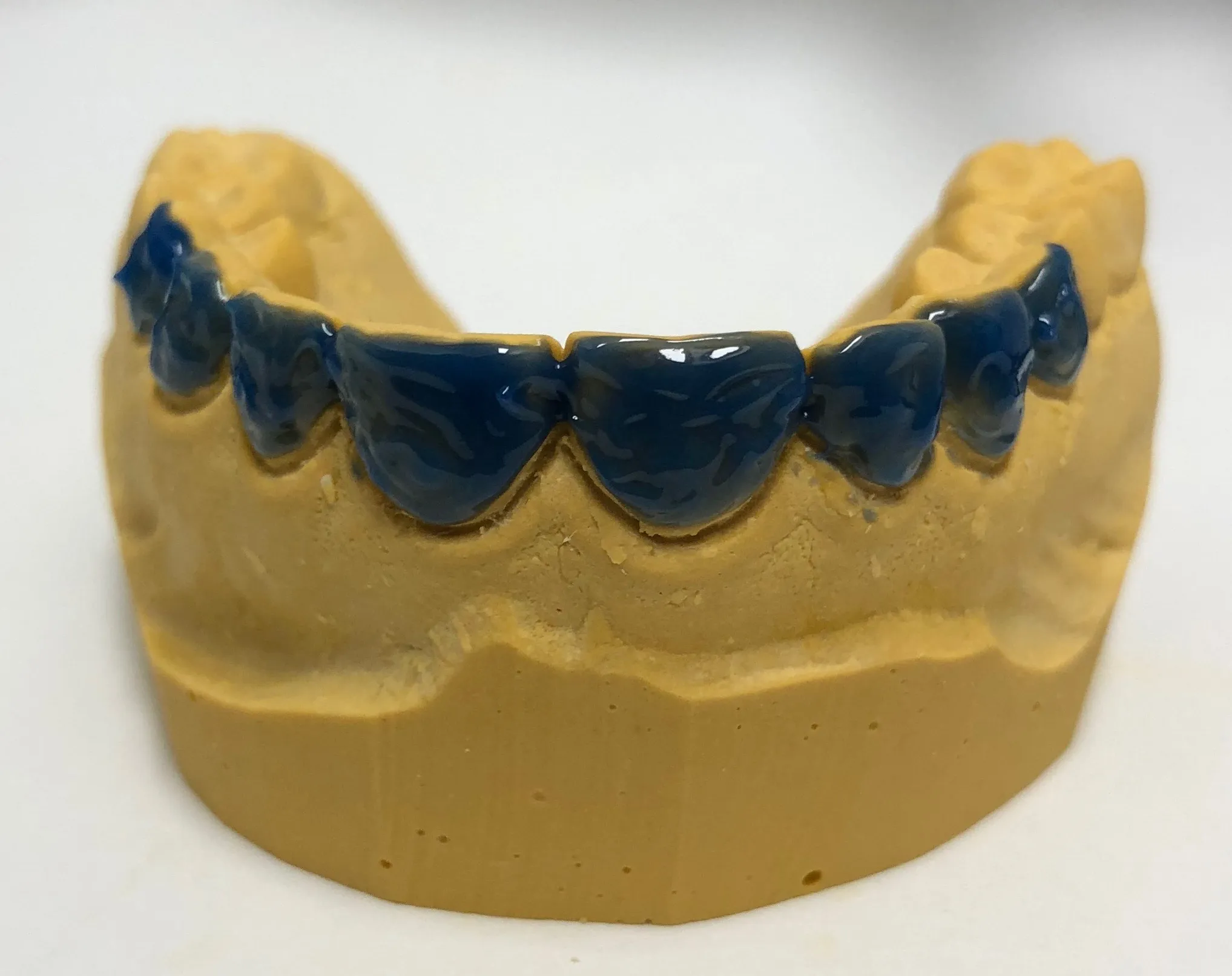 32091 teeth sensitivity