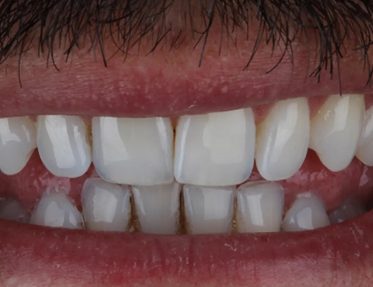 32098 healthy gums