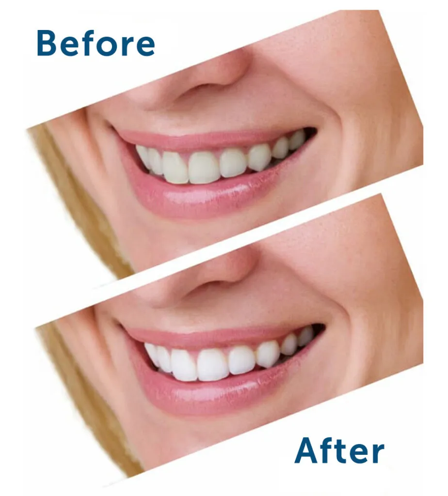 32108 gum irritation