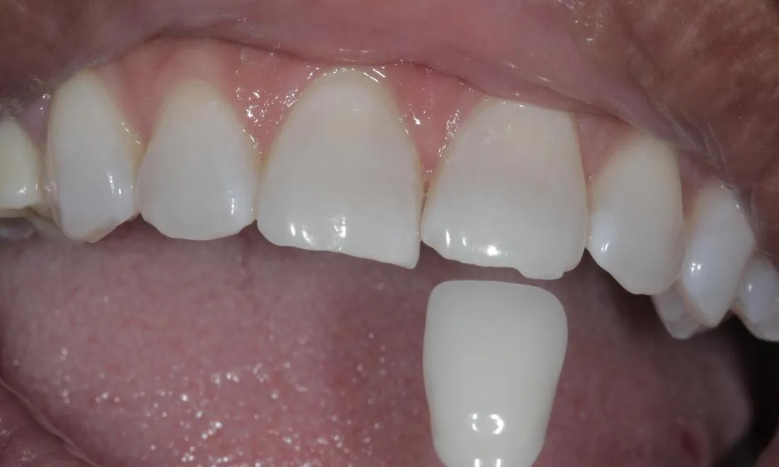 32109 bright smile maintenance