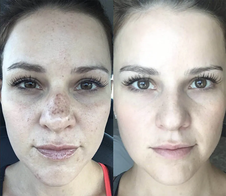 32120 skin assessment