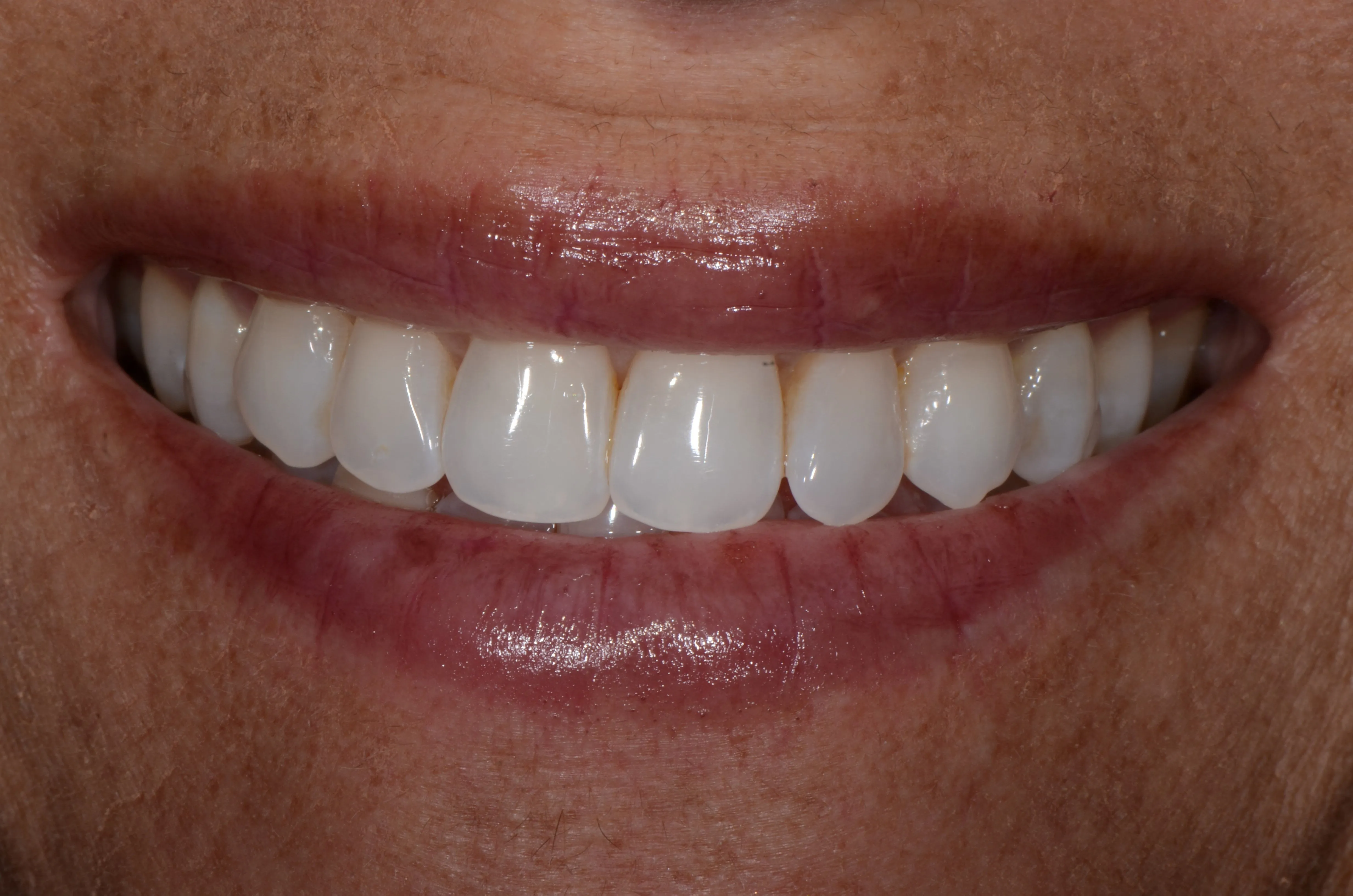 32121 teeth whitening smile