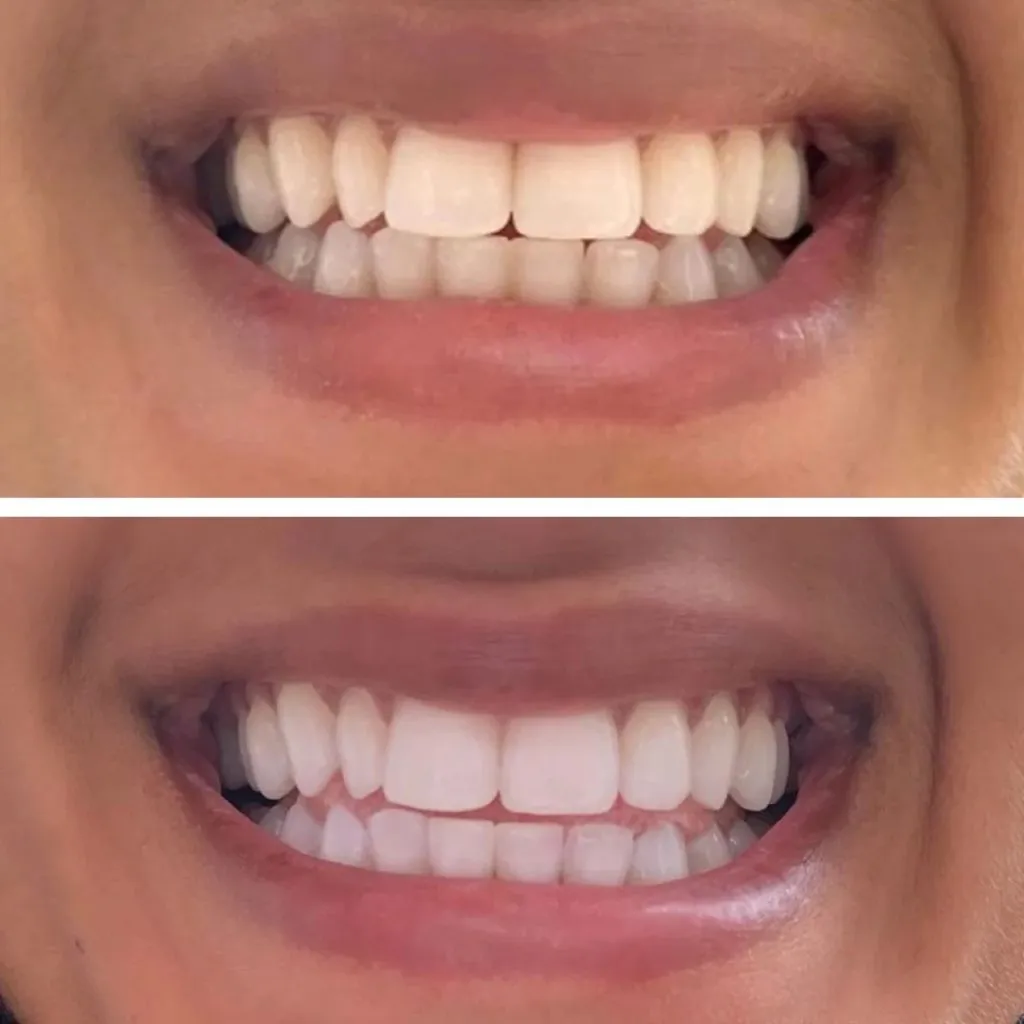 32121 teeth whitening toothpaste