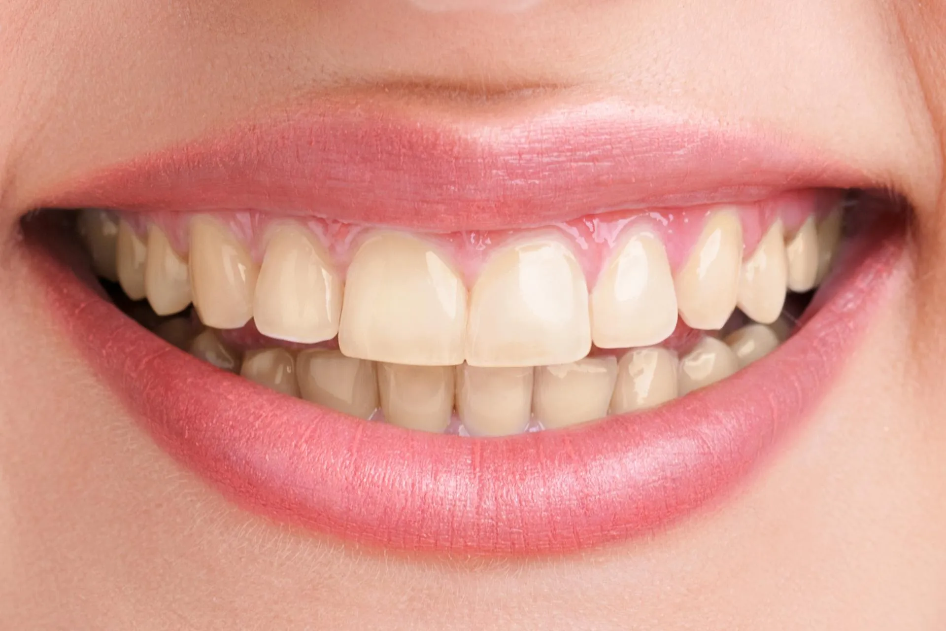/img/32131-teeth-whitening-consultation.webp