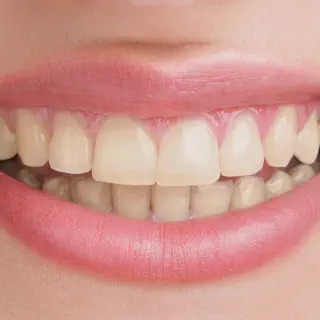 /img/32131-teeth-whitening-consultation.webp